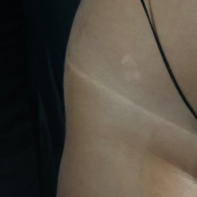 Golden Glow Membership at EnigmaEsthetics in Laurens, SC